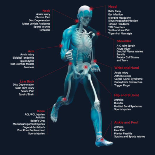 A/C Joint Sprain Rehabilitation